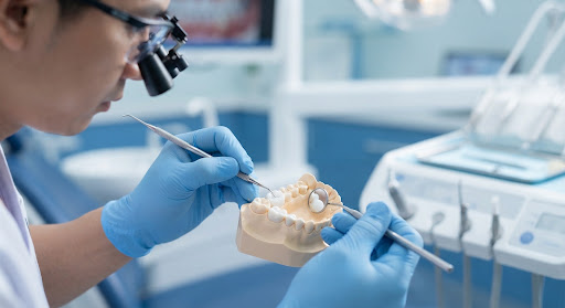 Trám răng thẩm mỹ