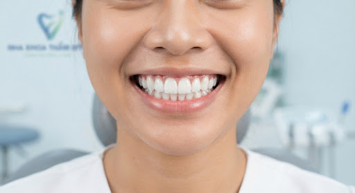 Răng sứ thẩm mỹ